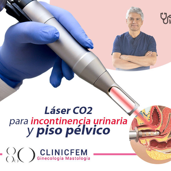 laser-co2-para-incontinencia-y-piso-pelvico