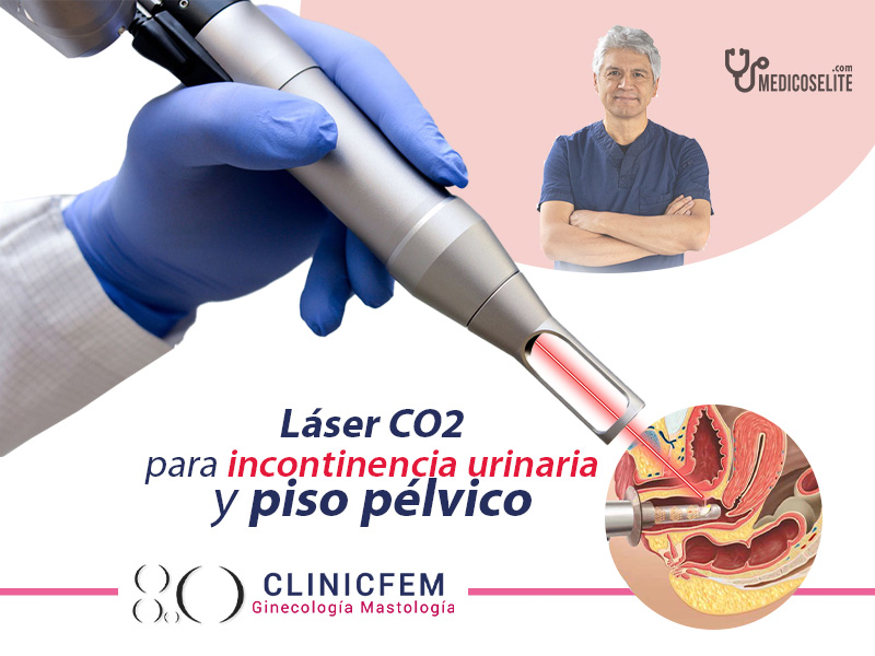 laser-co2-para-incontinencia-y-piso-pelvico