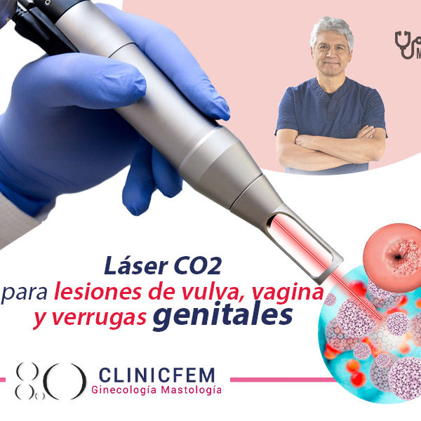 tratamiento-papiloma-quito-con-laser